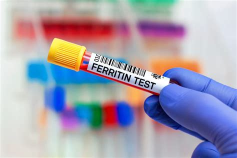 The Importance of Ferritin Levels for Optimal Health