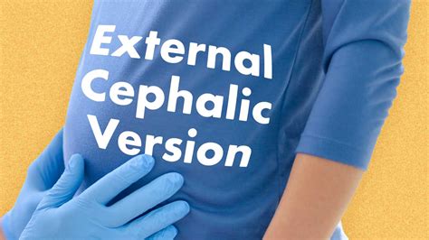 Evaluating External Cephalic Version | Ausmed