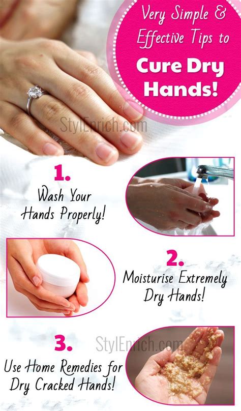 Home remedies for dry cracked hands | Dry cracked hands, Dry skin care, Natural skin care remedies