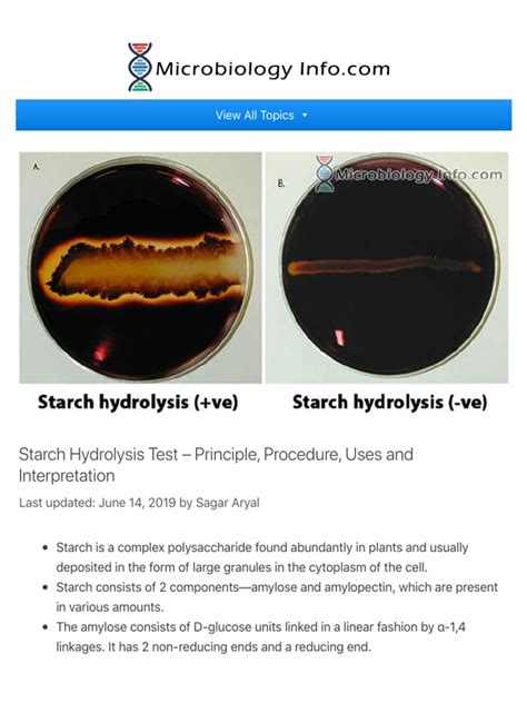 Starch Hydrolysis Test - Principle, Procedure, Us | PDF | Starch ...