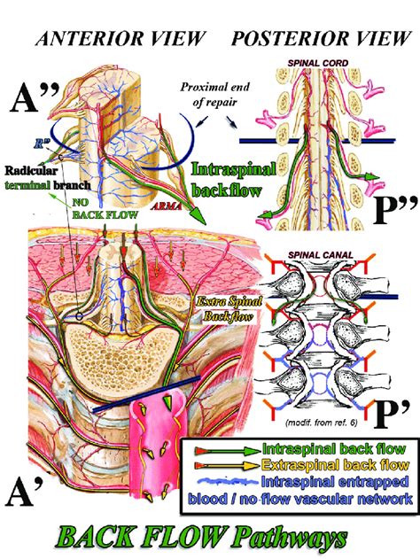 "Backflow" pathways. Intraspinal backflow can occur only through those... | Download Scientific ...