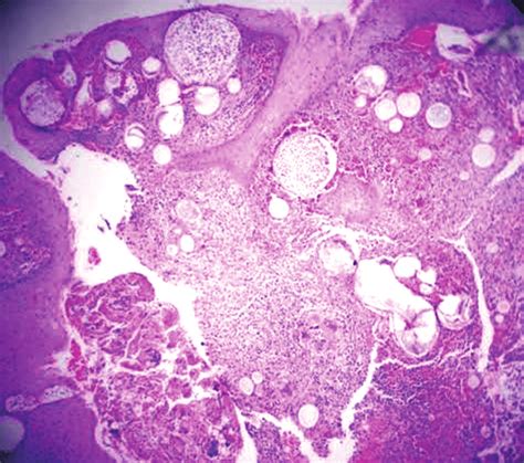 Round to oval sporangia of different stages of maturation with a ...