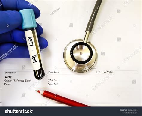 186 Partial thromboplastin time Images, Stock Photos & Vectors | Shutterstock