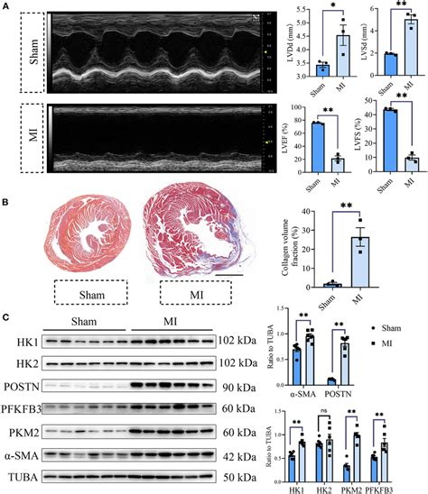 | Cardiac fibrosis was accompanied by enhanced glycolysis in MI mice.... | Download Scientific ...