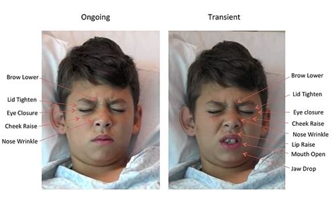 Staring Pain in the Face – Software “Reads” Kids’ Expressions to Measure Pain Levels