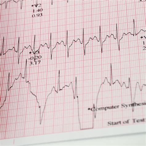 Advanced Medical Consumables and Care » Cheapest Consumables and Care Staffing