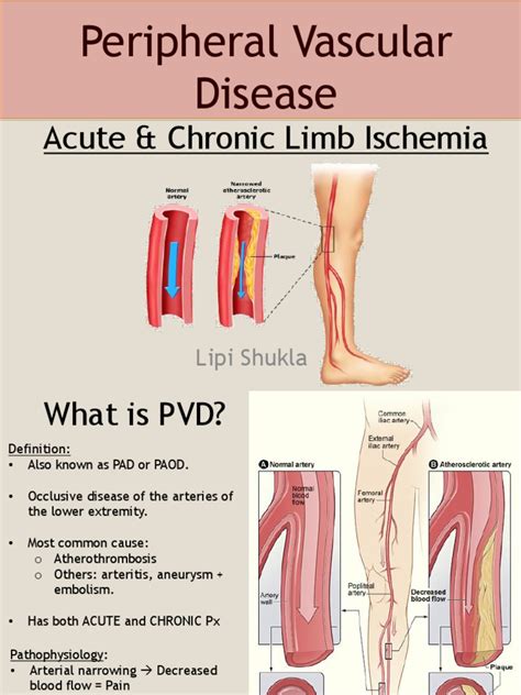 types of vascular disease Cardiovascular types disease diseases cvd ...