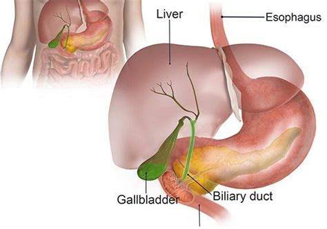 Bile duct surgery – gohealthiran