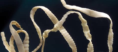 The Tapeworm... One of the Most Feared Parasites | Critter Science