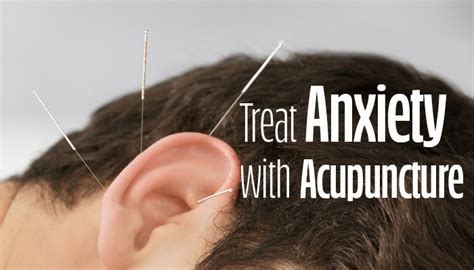 Treat Anxiety with Acupuncture | Han's Chiropractic & Acupuncture Palatine