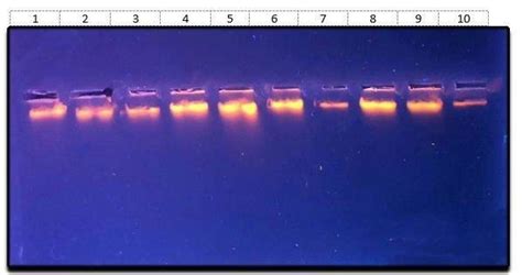 shows DNA bands of 9 isolates observed under UV transilluminator... | Download Scientific Diagram