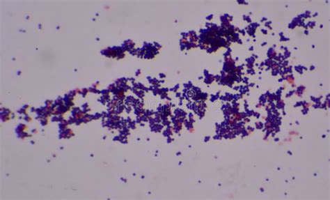 Cocci Bacteria Under Microscope