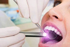 Laser Root Canal Therapy – Dentistry.com