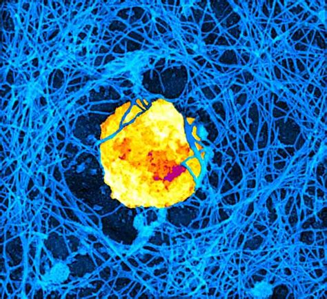 Natural killer cells and a microscope that breaks the laws of physics at CHOP