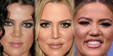 Khloe Kardashian FINALLY Admits To Having PLASTIC Surgery! She Just ...