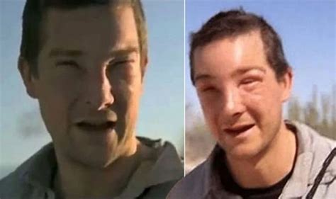 Bear Grylls health latest: Survival expert’s allergic reaction to a bee ...