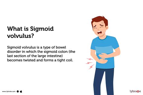 Sigmoid volvulus: Causes, Symptoms, Treatment and Cost