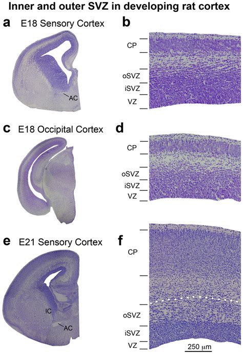 Inner and outer SVZ in the developing rat cortex. (a, c, e)... | Download Scientific Diagram