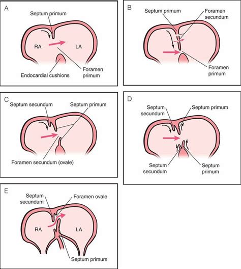 Embryology of the Heart | Obgyn Key | Cardiología, Imagenologia, Medicina