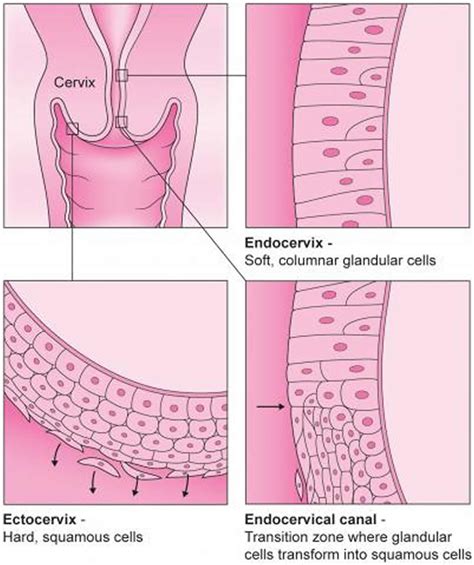 Colposcopy - Colposcopy Biopsy, Results, HPV, Side Effects