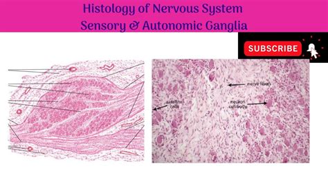 Histology of Ganglia | Sensory Ganglia | Autonomic Ganglia | Features ...