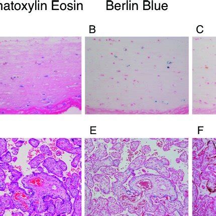 Placental histology. Hematoxylin-eosin staining (A, D). Hemosiderin... | Download Scientific Diagram