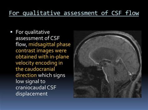 CSF flow study | PPT