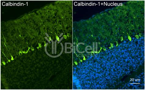 Calbindin-1 (CALB1 or Calbindin D-28K) antibody - BiCell Scientific®