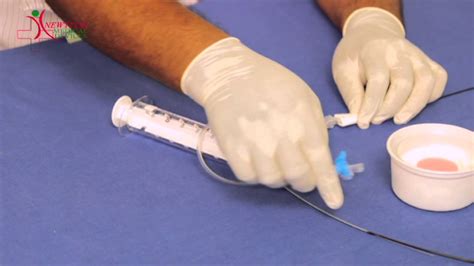 Aspiration Catheter Kit - YouTube