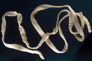 Parasite Worms In Humans