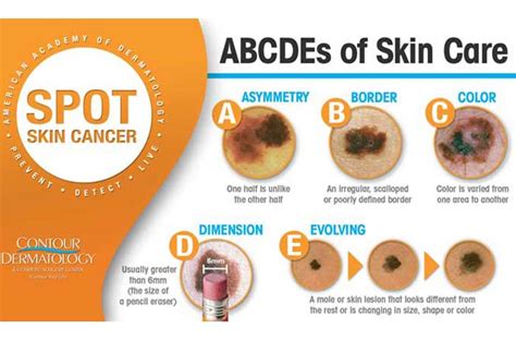 Medical Dermatologist | Treatment of Skin Conditions