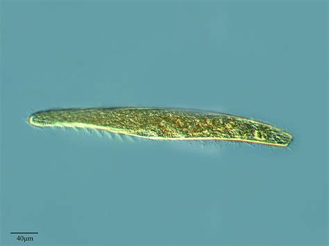 Spirostomum - Alchetron, The Free Social Encyclopedia