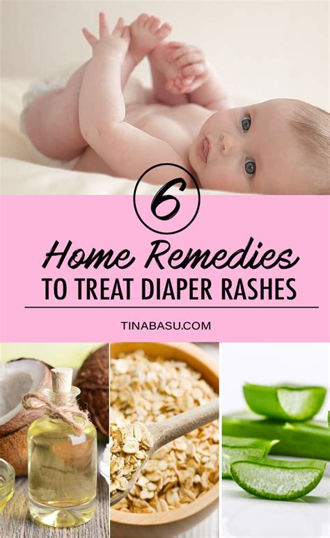 6 Effective Home Remedies to Treat Diaper Rash In Babies #babycare