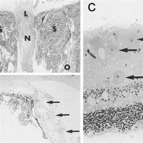 Microanatomy of the sperm whale eye. (A) Longitudinal section of the ...