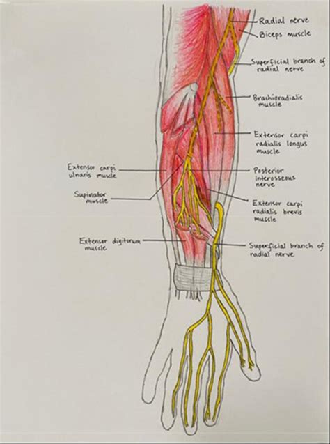 Removed accessory BR slip and the freed superficial radial nerve. BR,... | Download Scientific ...