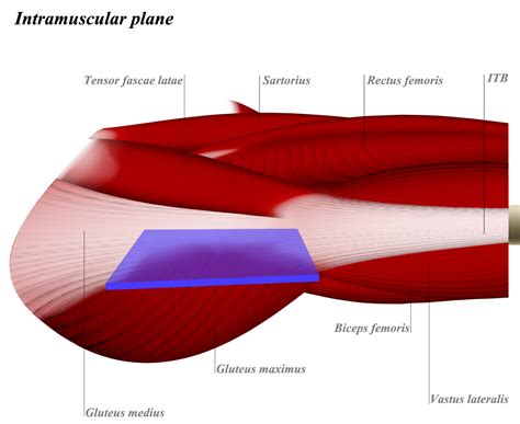 Vastus lateralis - Anatomy - Orthobullets