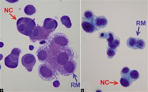 Mesothelial Cells