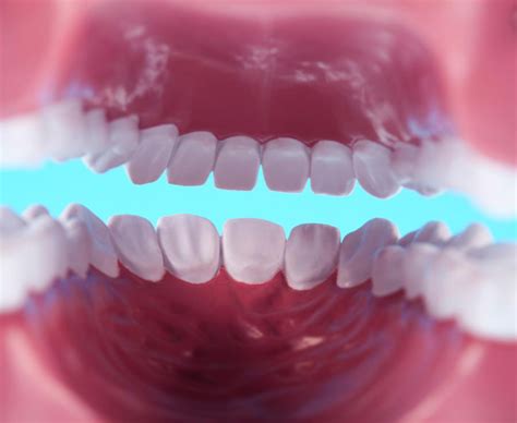 Different Types of Gum Diseases