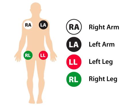 12-Lead ECG Placement Guide with Illustrations | Patient care technician, Ecg nursing, Nursing ...