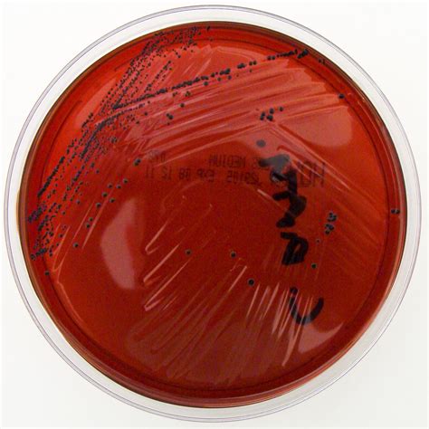 Corynebacterium diphtheriae on Hoyles Agar | Nathan Reading | Flickr