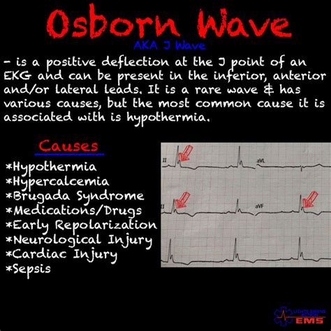 Osborn Wave | Emt, Waves, Lights and sirens