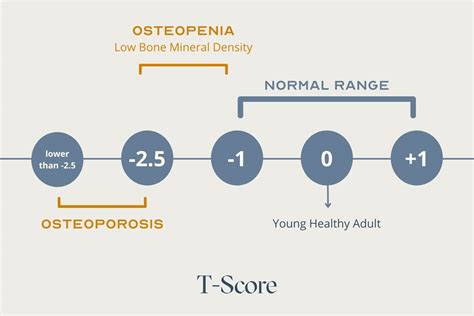 The Best Osteopenia Exercises