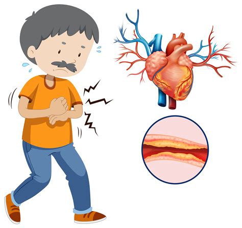 A Human Heart Problem on White Background 299123 Vector Art at Vecteezy