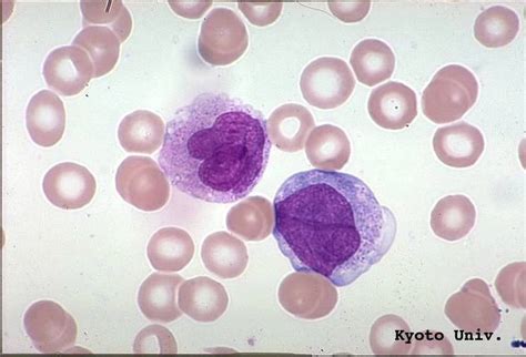 Monocyte