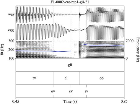 Example of a voiced plosive with partial closure voicing and ...