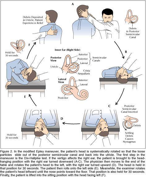 Printable Vertigo Exercise Chart