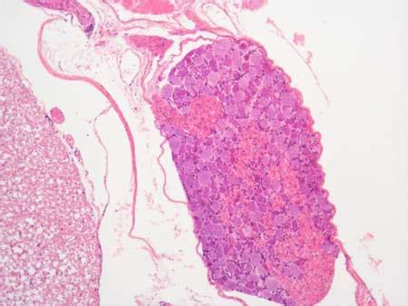 Ganglion Histology