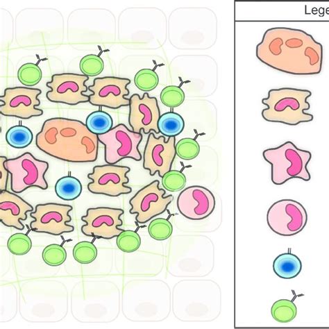 Model of the cellular organization of a non-caseating granuloma.... | Download Scientific Diagram