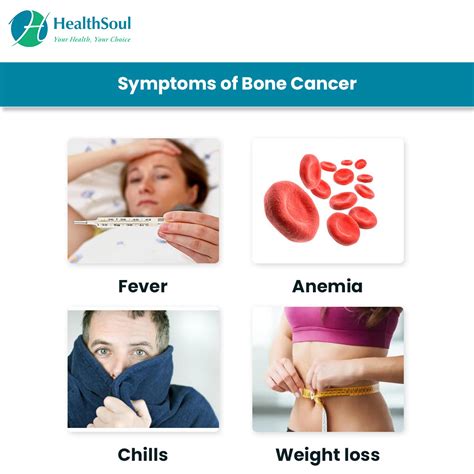 Bone Cancer: Symptoms and Treatment – Healthsoul