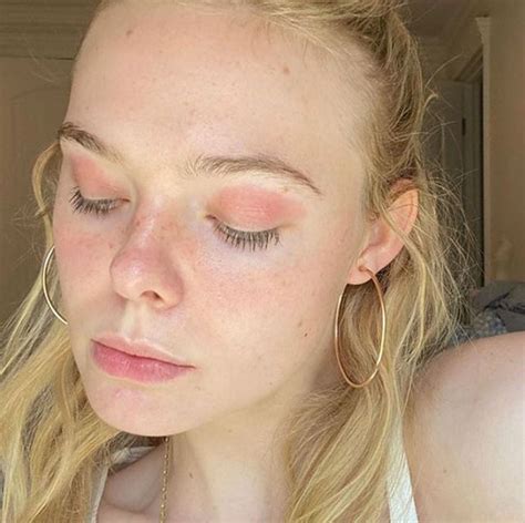 Elle Fanning Shares Photos Of Eczema Outbreak On Eyelids